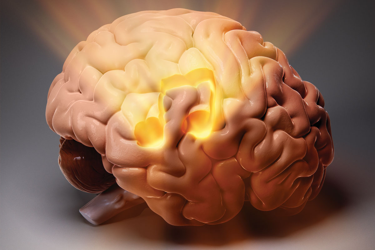 ilustración de un cerebro con una nota musical